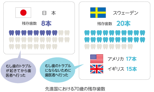 先進国における70歳の残存歯数（スウェーデン20本、アメリカ17本、イギリス15本に対して、日本は8本）